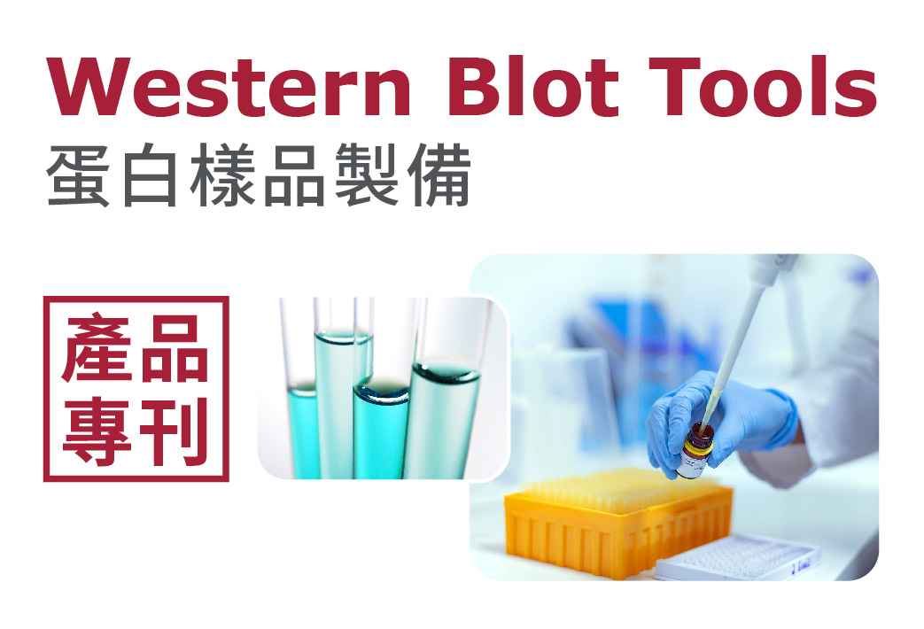 電子報363期 : Western Blot - 蛋白樣品製備工具精選