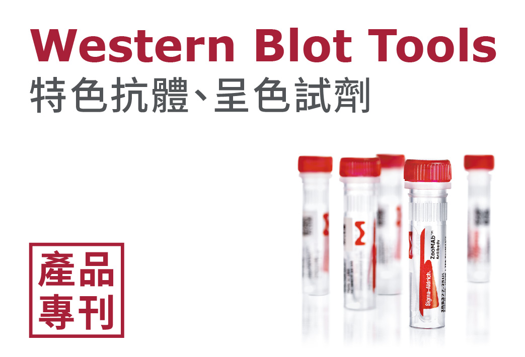 電子報371期 : Western Blot Tools (Part 3) - 特色抗體、呈色試劑